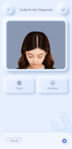 두피진단_1